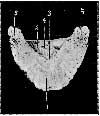 THIRD PHALANX OR OS PEDIS