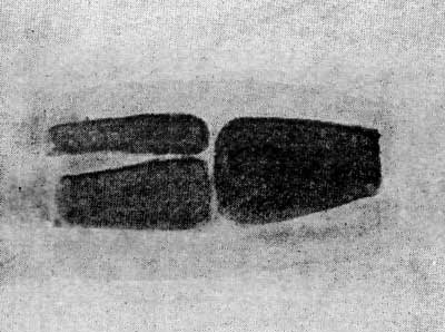 FIGURE 4.&mdash;SKETCH OF A BABY'S KNEE.