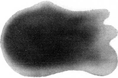 FIGURE 5.&mdash;SKIAGRAPH OF A BULLOCK'S EYE.