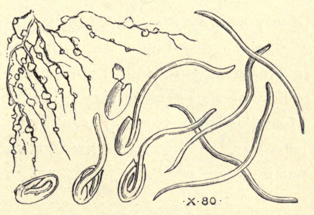 [Illustration: Cucumber Eel-worms and eggs]