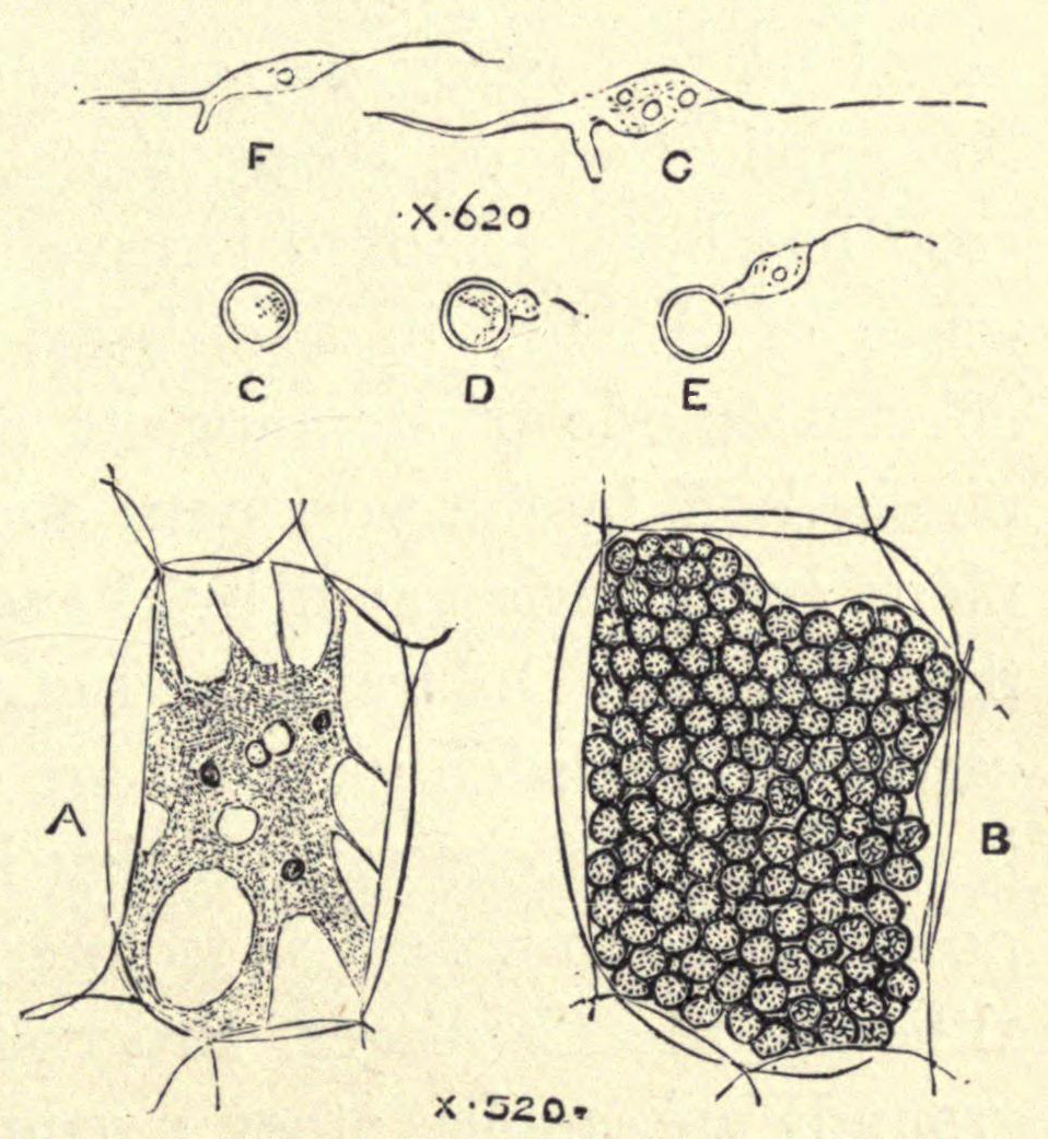 [Illustration: Fungus of Finger-and-Toe Disease]