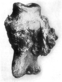 Fig. 19—Phalangeal exostoses in chronic ringbone. Museum
specimen of the Kansas City Veterinary College.