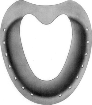 Fig. 36—Superior surface, showing concavity or bowl, as
formed by the toe and branches of the shoe, as designed by Dr. David W. Cochran.