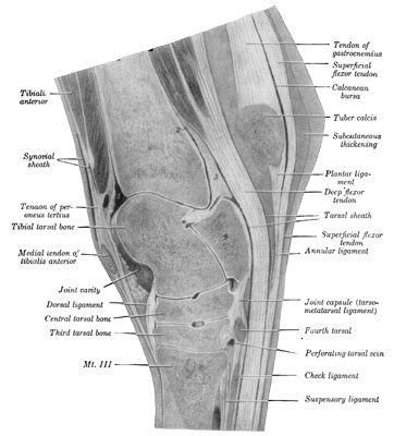 Fig. 40—Sagital section of right hock. The section
passes through the middle of the groove of the trochlea of the tibial
tarsal bone. 1 and 2. Proximal ends of cavity of hock joint. 3. Thick
part of joint capsule over which deep flexor tendon plays. 4. Fibular
tarsal bone (sustentaculum). A large vein crosses the upper part of the
joint capsule (in front of 1). (From Sisson's ''Anatomy of the Domestic
Animals.'')
