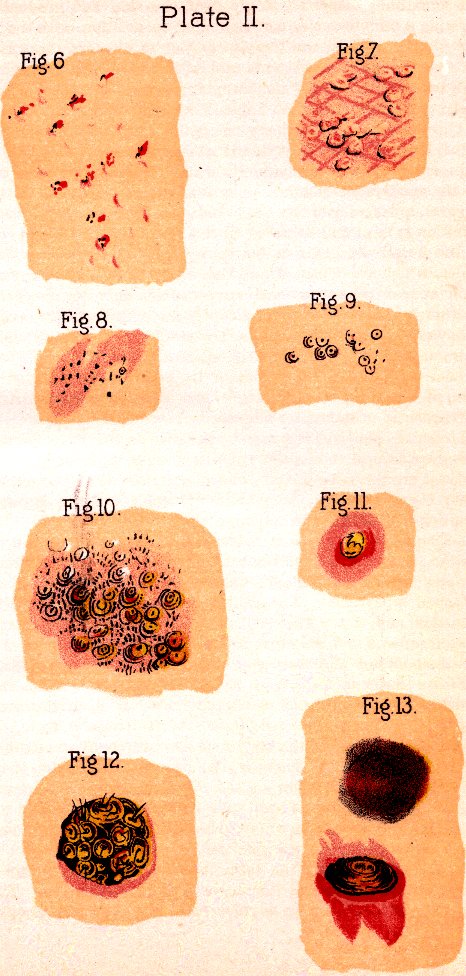 Illustration:
Plate II. Fig. 6. Fig. 7. Fig. 8. Fig. 9. Fig. 10. Fig. 11. Fig. 12. Fig.
13.