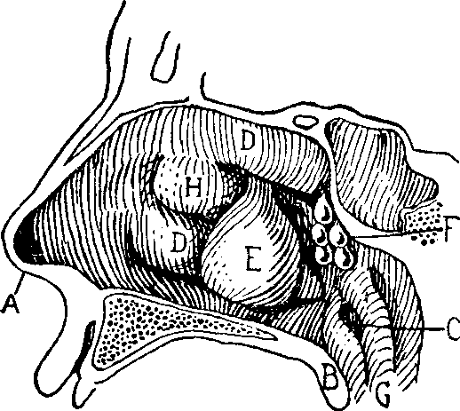 Illustration:
Fig. 13. NASAL POLYPI.