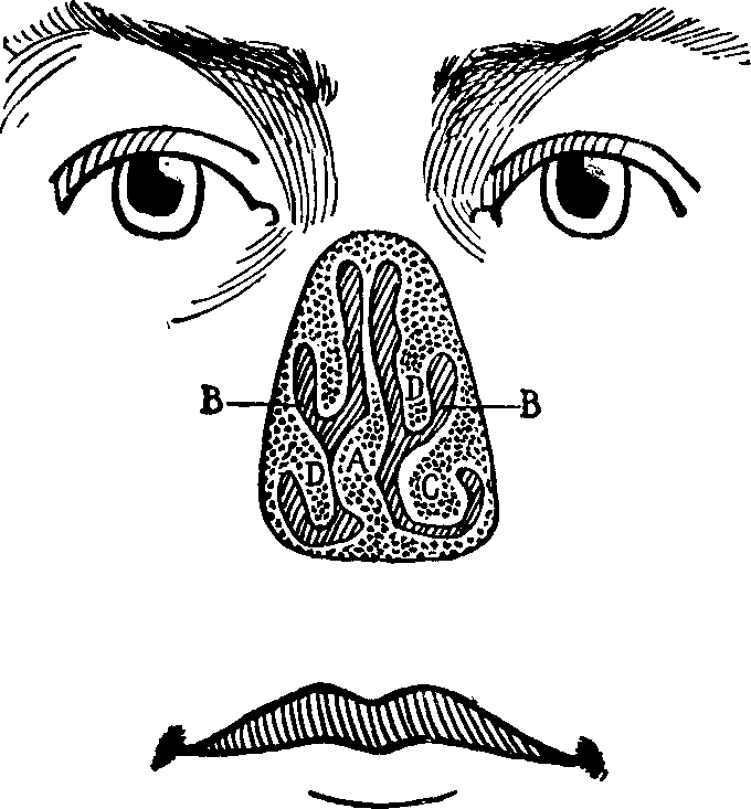 Illustration:
Fig. 15. Anterior view of deformed nasal passages as seem with the
projecting portion of the nose removed.