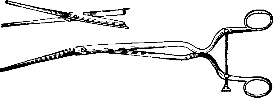 Illustration:
Fig. 5.  STOHLMAN'S HYSTEROTOME.  This instrument has two cutting blades
which shut past each other, as seen in the lower figure, so as not to cut
when introduced into the canal of the uterine neck. After introduction, the
cutting blades are separated, as shown in the upper figure, the extent of
the incision being regulated by the thumb-screw attached to the handles, as
represented in the lower figure.