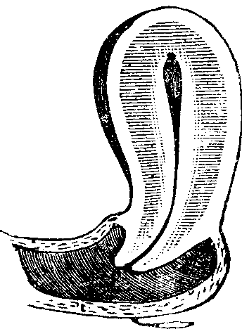 Illustration:
Fig. 9. Conoid Neck.
