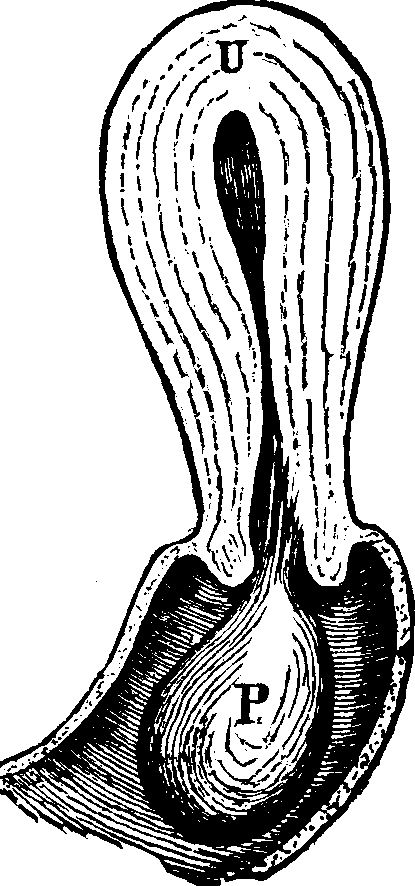 Illustration:
Fig. 21. U, Uterus. P, Polypus.
