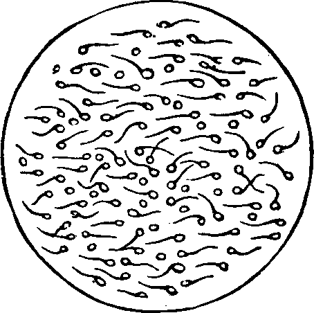 Illustration:
Fig. 3. Microscopic appearance of healthy semen.