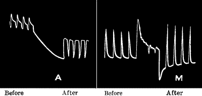 Fig. 115.—Increased Response after Continuous Stimulation in Nerve and Metal