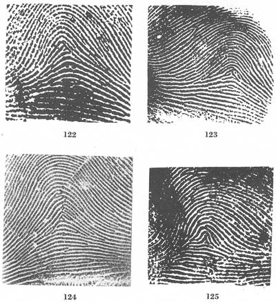 Figs. 122-125 Figs. 122-125