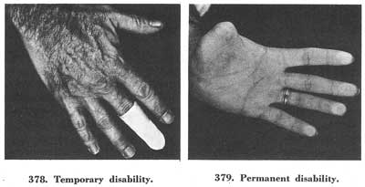 Figs. 378-379 Figs. 378-379