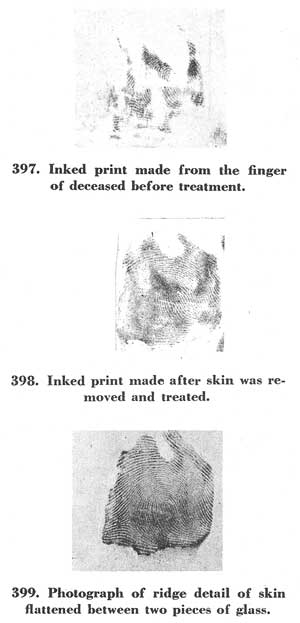 Figs. 397-399 Figs. 397-399