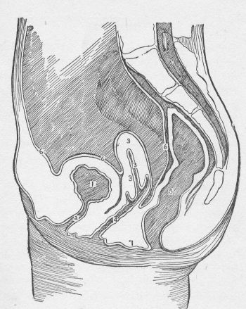 1. Bladder 2. Urethra 3. Uterus 4. Vagina 5. Rectum 6. Peritoneum 7. Perineum VERTICAL SECTION OF PELVIS