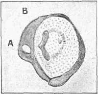 Fig. 3.—Drum of Grasshopper's Ear, greatly magnified.