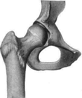 A BALL-AND-SOCKET JOINT