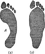IMPRINT OF (1) ARCHED FOOT AND (2) FLAT FOOT