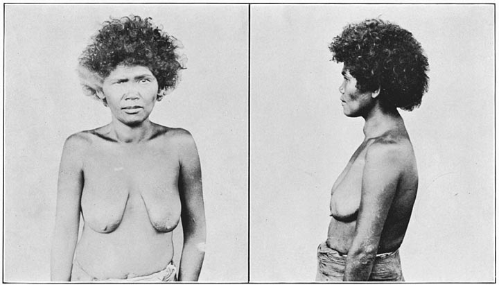 Negrito woman of Zambales (mixed blood).