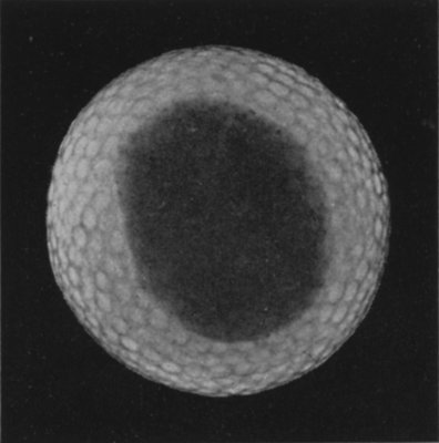 AN X-RAY PHOTOGRAPH OF A GOLF BALL, REVEALING AN IMPERFECT CORE