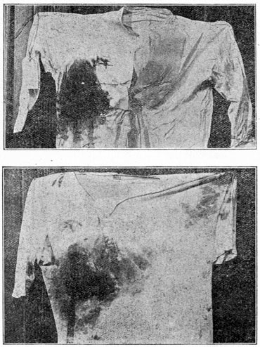 Shirts Worn by Ex-President Roosevelt Showing Extent of Bleeding from Wound While He Spoke to 9,000 People.