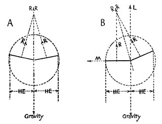     R, Direction of reaction of wing indicated.
  R R, Resultant direction of reaction of both wings.
    M, Horizontal (sideway) component of reaction.
    L, Vertical component of reaction (lift).