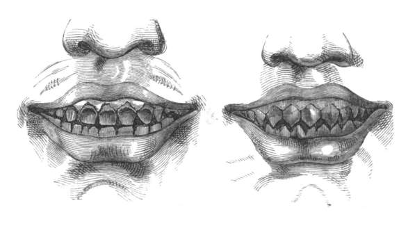 Teeth of Dyaks