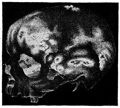 An internally-lit skull.