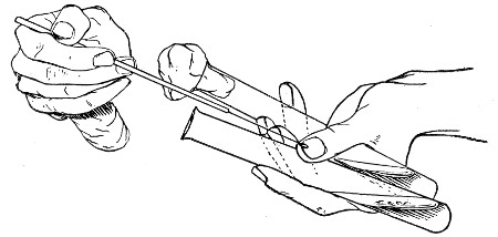 Fig. 117.—Inoculating tubes, seen from the front.
