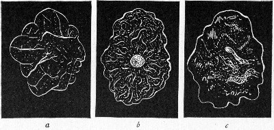 Fig. 146.—Types of colonies: a, Reticulate; b,
gyrose; c, marmorated.