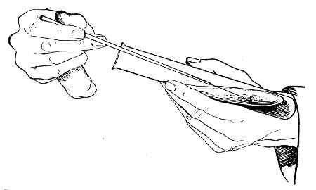Fig. 68.—Holding tubes for removing bacterial growth, as
seen from the front.