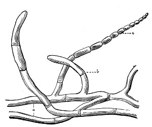 Fig. 80.—Oïdium.
