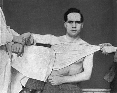 Fig. 23.—Miller's Method of reducing Sub-coracoid
Dislocation—First Movement.