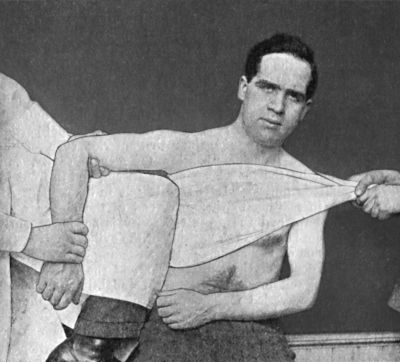 Fig. 24.—Miller's Method of reducing Sub-coracoid
Dislocation—Second Movement.
