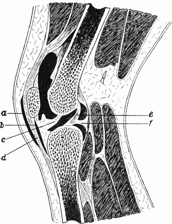 Fig. 80.—Section of Knee-joint showing extent of
Synovial Cavity.