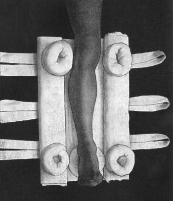 Fig. 91.—Box Splint for Fractures of Leg.