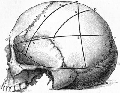 Fig. 181.—Chiene's Method of Cerebral Localisation.