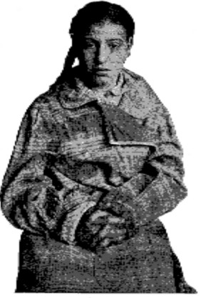 Fig. 74.—Schoolgirl with adenoids.