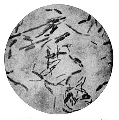 Photo-Micrograph of Smear from Greek Curdled Milk Called 'Giaourti'