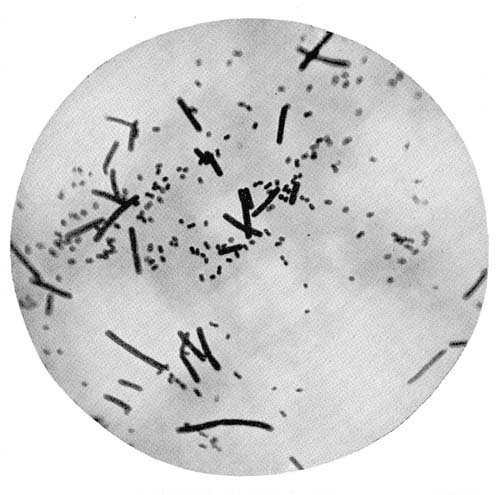 Photo-Micrograph of Smear of Combined Culture of Bacillus bulgaricus and Bacteria paralacticus
