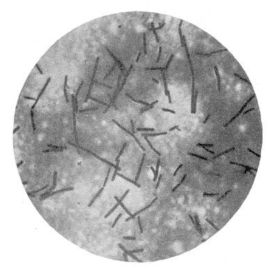 Photo-Micrograph of Smear of One-Month Culture of Bacillus bulgaricus