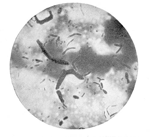 Photo-Micrograph of Smear from Milk that had been Allowed to Sour Spontaneously
