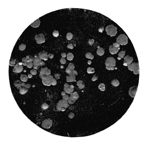 Photograph of Agar Culture, Inoculated with a Lactic Powder