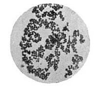 Staphylococcus pyogenes albusr