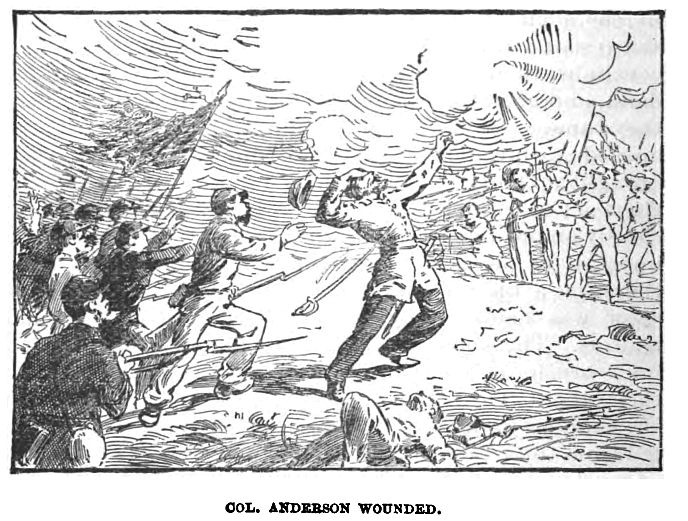 Col. Anderson Wounded 059 