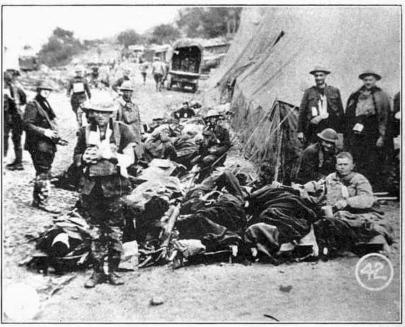 WOUNDED FROM THE ARGOXNE AT CHEPPY.