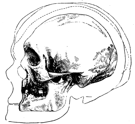 Outlines of Three Prehistoric
  European Skulls compared with an American Skull from
  Hochelaga.