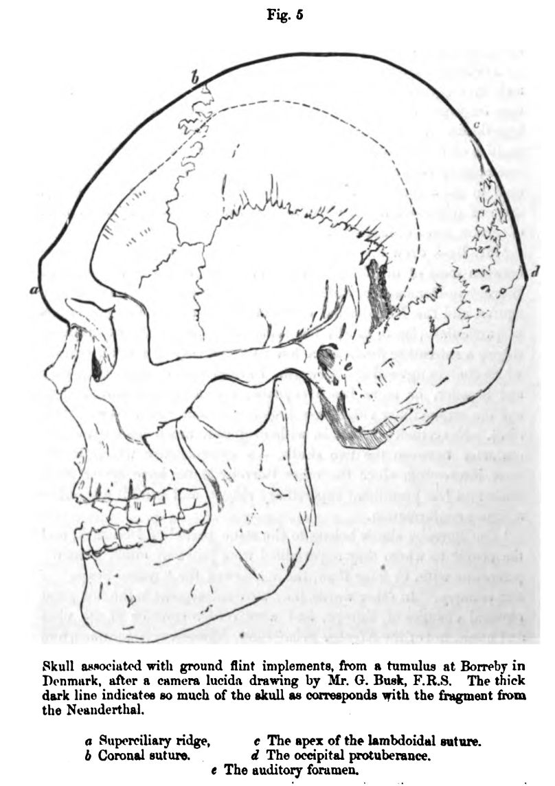 Figure 5. Skull 