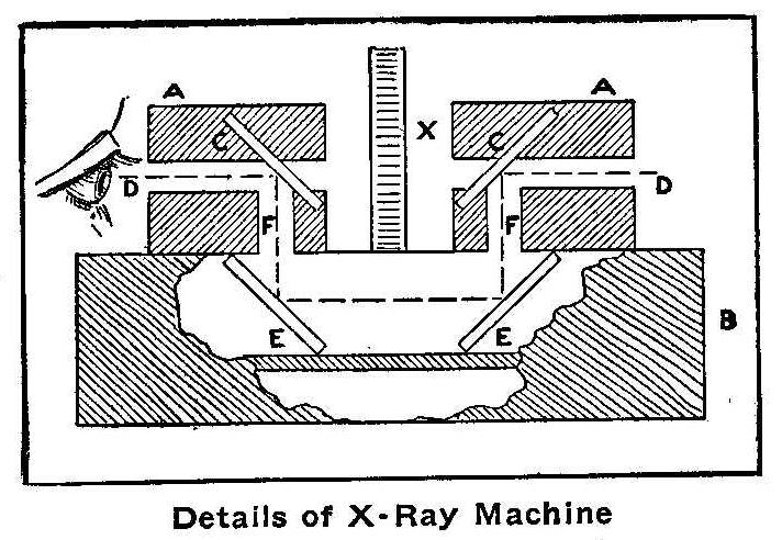 Details of X-Ray Machine